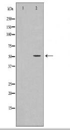 ADCYAP1R1 Antibody
