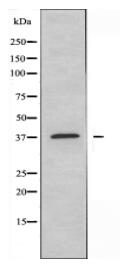 DNAJB4 Antibody