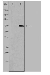 ABCD1 Antibody