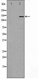 COL2A1 Antibody