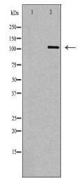 CBLB Antibody