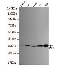 PCNA Mouse mAb