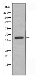 AGTR1 Antibody
