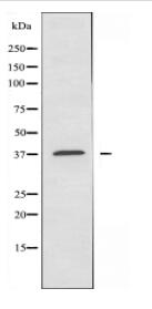 AVPR2 Antibody