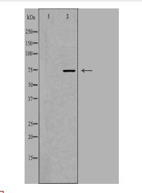 ACSS1 Antibody