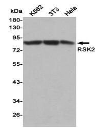 RSK2 Mouse mAb