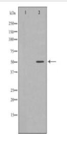 GABRA2 Antibody