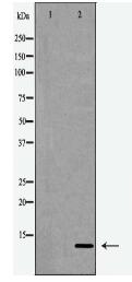 CKS1 Antibody