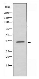CLNS1A Antibody