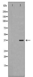 DNAJB1 Antibody