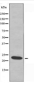 AKAP14 Antibody