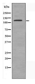 ALPK1 Antibody