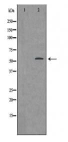 BMP3 Antibody