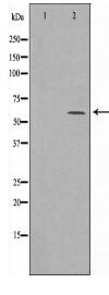 CDK5RAP3 Antibody