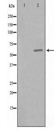 CCT6A Antibody