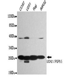 UCHL1/PGP9.5 Mouse mAb