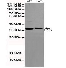 Protein Phosphatase 4C Mouse mAb