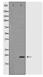CD3D Antibody