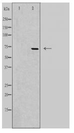 ABCF2 Antibody