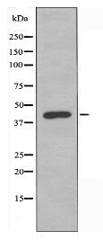 CDKL1 Antibody