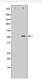 ACVR1C Antibody