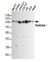 Hexokinase 1 Mouse mAb