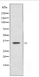 CNOT7 Antibody