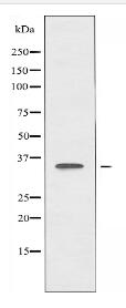ANKRD1 Antibody