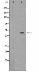 AMACR Antibody
