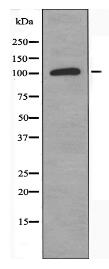 ADCY4 Antibody