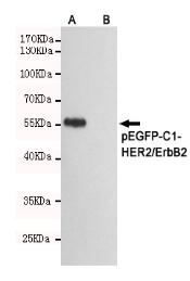 HER2/ErbB2 Mouse mAb