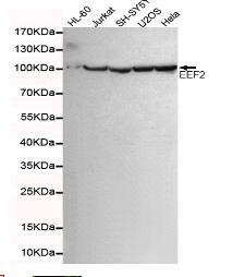 eEF2 Mouse mAb
