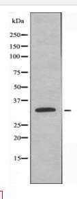 ASAH3L Antibody