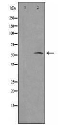 5-HT-2B Antibody