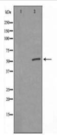 GSDMC Antibody