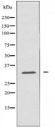 CEACAM21 Antibody