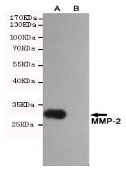 MMP-2 Mouse mAb