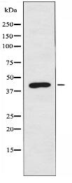 CCKAR Antibody