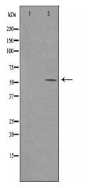 ARMC6 Antibody