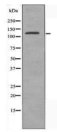 ADAMTS18 Antibody