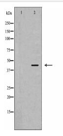 ARPC1A Antibody