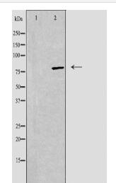 ADD2 Antibody