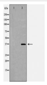DOK4 Antibody