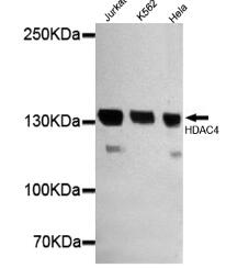 HDAC4(N-term) Mouse mAb