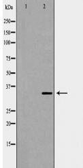 CD79B Antibody