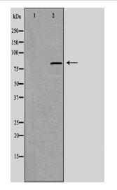 ANKK1 Antibody