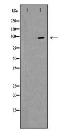 ABCC4 Antibody