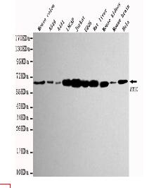 ATIC Mouse mAb