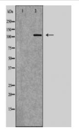 ATP2A2 Antibody