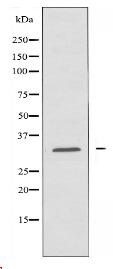 CCNB1IP1 Antibody
